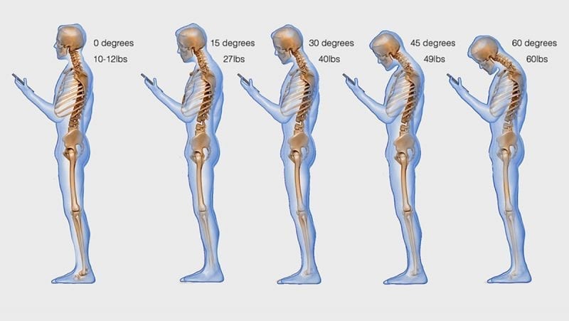 Text neck syndrome o collo da smartphone